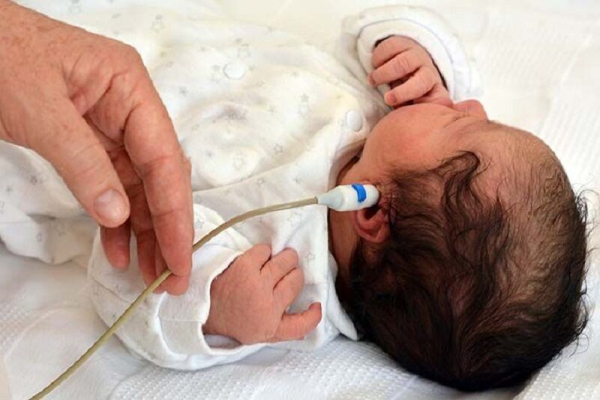 ۱۱ هزار نوزاد از نظر شنوایی غربالگری شدند