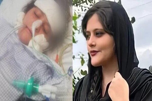 نظریه پزشکی قانونی در مورد فوت مهسا امینی