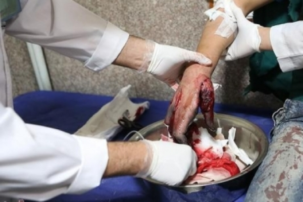 چهارشنبه سوری در خراسان&zwnj;شمالی ۳۷ مصدوم داشت